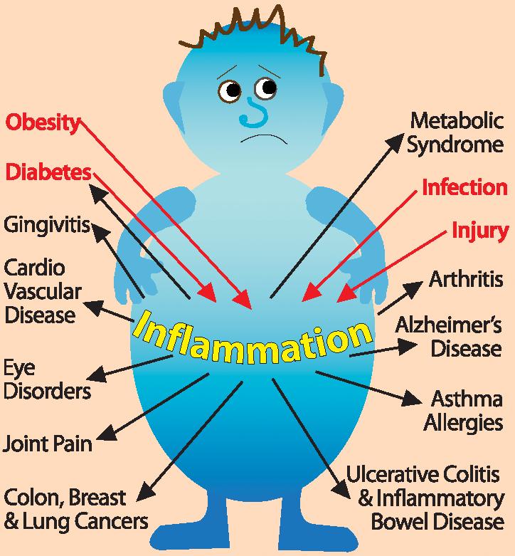 gastritis-an-inflammation-irritation-or-erosion-of-the-lining-of-the